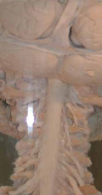 Davida Leó agy-gerincvelő készítménye