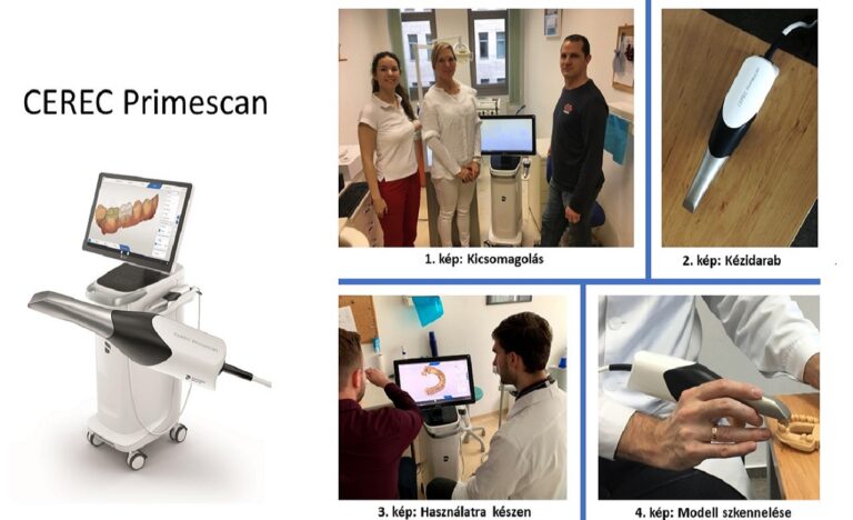 CEREC – Intraorális szkennerek