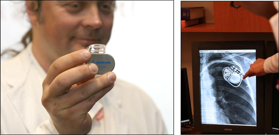 MRI-compatible pacemaker