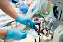 Mechanical circulatory support devices are usually used in the cardiac operating room, the hemodynamic laboratory, or the ICU, where cardiovascular technicians are active participants in the work process. Their tasks include selecting cannulas, preparing and starting the device, and then monitoring the machine’s functions and integrity. When working in the ICU, cardiovascular technicians are involved in operating and monitoring the circulatory support machines of patients in a critical condition.