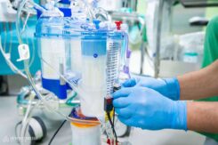 The cardiovascular technician’s job is to prepare the heart-lung machine before surgery, aseptically (without infection) install the disposable tubing set, fill it with infusion solution, and remove the air from it. “With adequate anticoagulation, the surgeon inserts venous and arterial cannulas (this can be done at several points in the vascular system or heart), to which we attach the machine’s tubing set,” Zoltán Merkl noted, explaining the process. Several safety features, such as blood level, bubble, pressure, and flow sensors, ensure that the procedure is safe. In the photo, Zoltán Merkl is placing a level sensor on the venous reservoir.