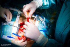 They can then operate on a stationary and bloodless heart, while the patient’s circulation is maintained by the motor, which is controlled by the perfusionist.