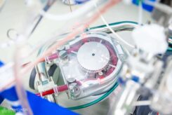 At the end of the operation, the cardiovascular technician gradually returns circulation to the patient’s own heart and then shuts down the machine. Finally, they complete the necessary documentation, clean the equipment, and prepare it for disinfection.