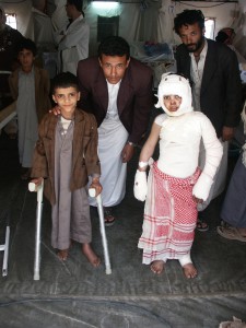Osteomyelitis és égés-Jemen