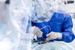 Csongor különösen értékesnek tartja, hogy a sebészek munka közben magyaráznak, válaszolnak a kérdésekre, és megosztják saját, évek alatt kialakított technikai „trükkjeiket”.