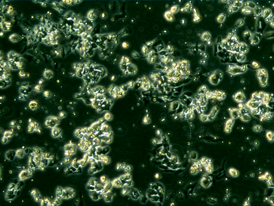 SCLC cells in culture