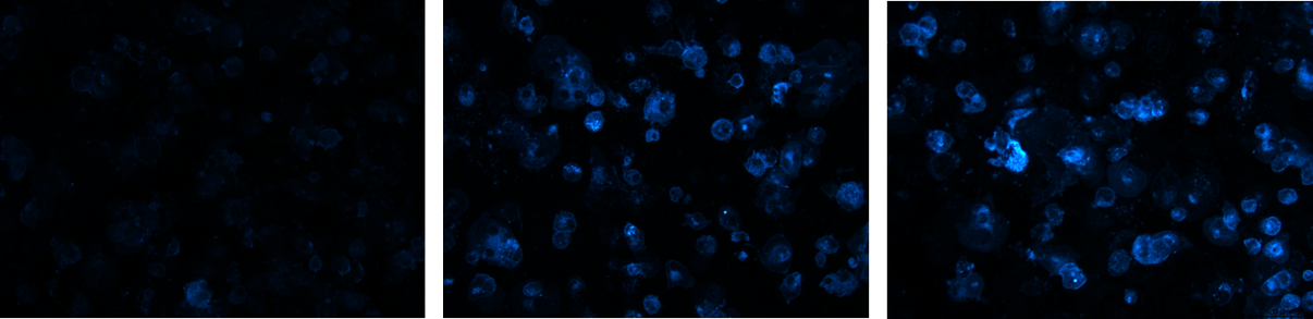 Fluorescence images of cholesterol uptake by THP1-ASC-GFP cells after treatment with different concentrations of hypercholesterolemic supplements.